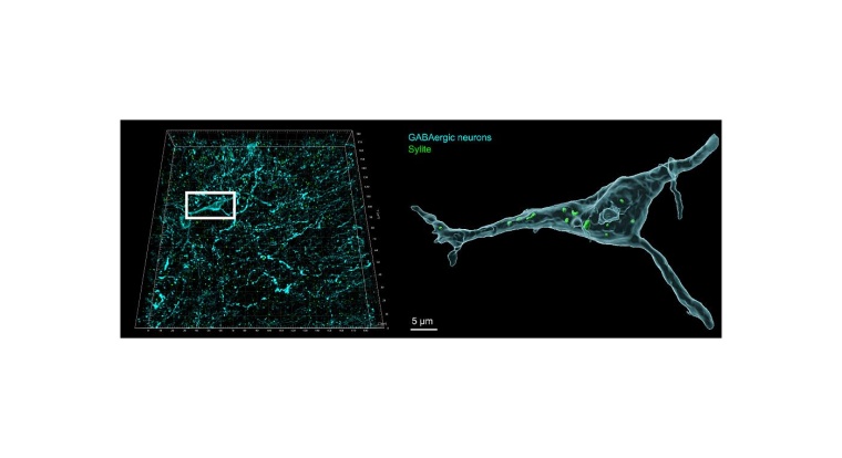 Sylite-Färbung (grün) eines Mittelhirnschnitts - Sylite-Färbung (grün)...