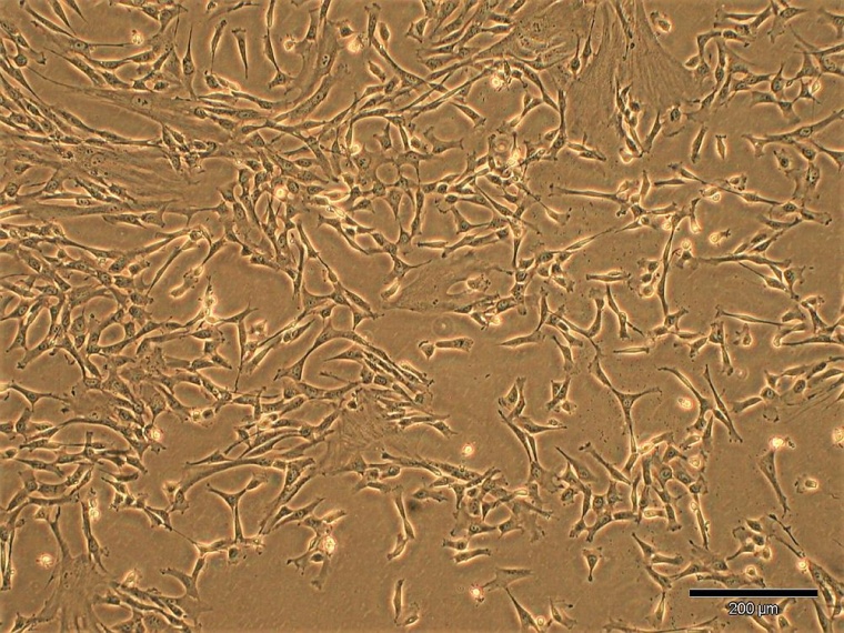 Mikroskopische Aufnahme der kultivierten menschlichen mesenchymalen Stammzellen...