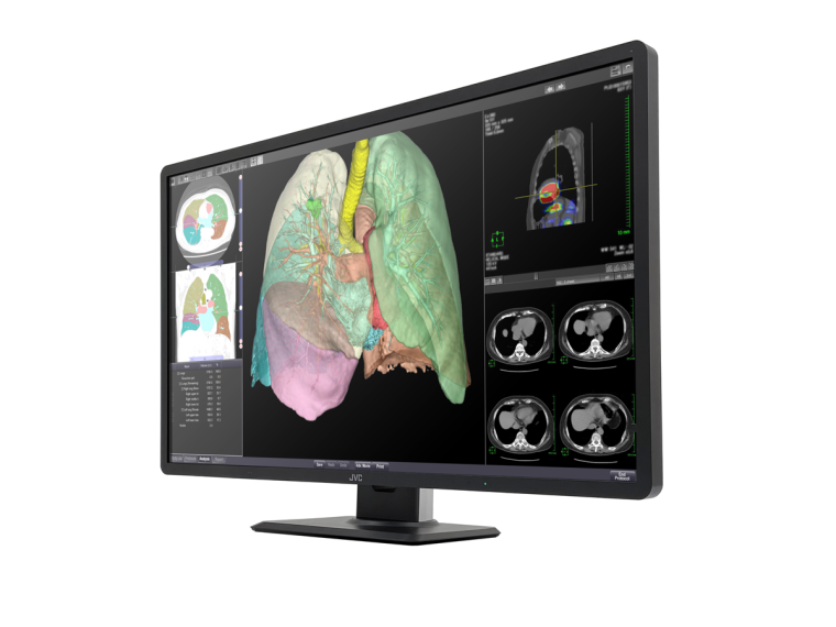 Mit dem CL-R813 bietet JCVKenwood Radiologen den idealen Farbmonitor für die...