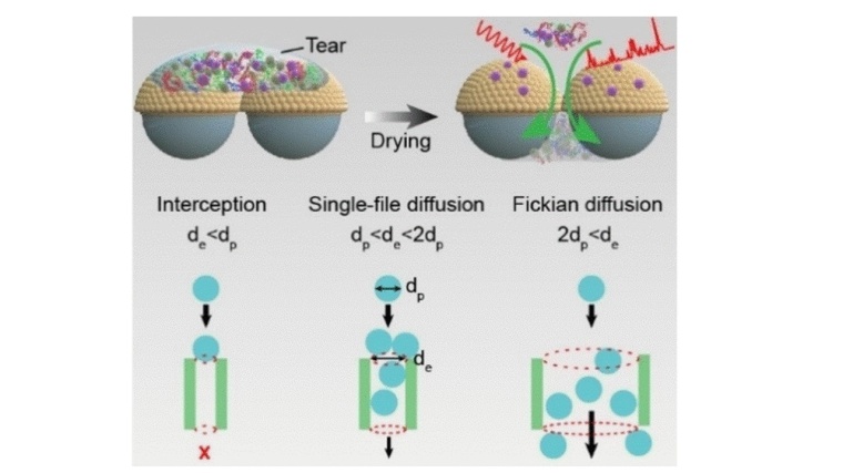 Sensor mit Trennwirkung: Gelbsucht-Diagnose anhand von Tränenflüssigkeit....