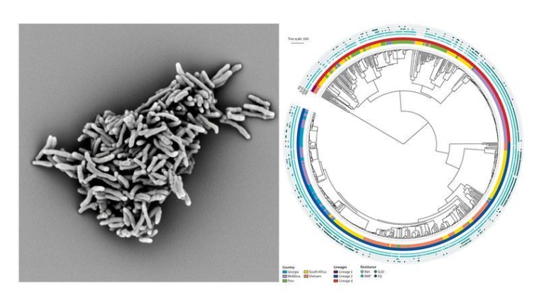 Elektronenmikroskopische Aufnahme von Mycobacterium tuberculosis (links);...