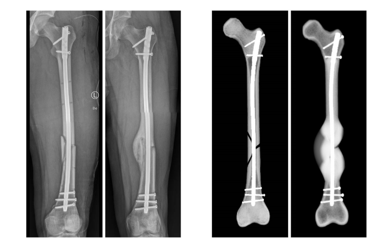 Links: Röntgenbilder des realen Heilungsverlaufs eines Beispielpatienten....