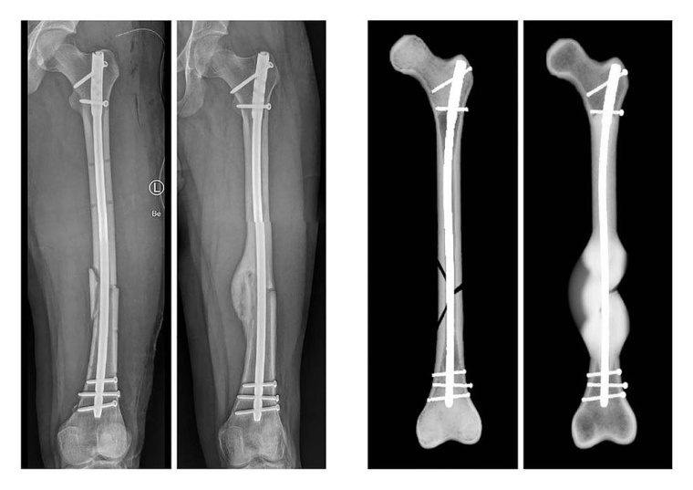 Röntgenbilder des realen Heilungsverlaufs eines Beispielpatienten....