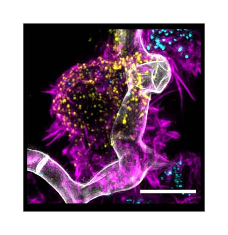 Pilz-CAR-T-Zell-Interaktion: in grau Aspergillus fumigatus, in Magenta...