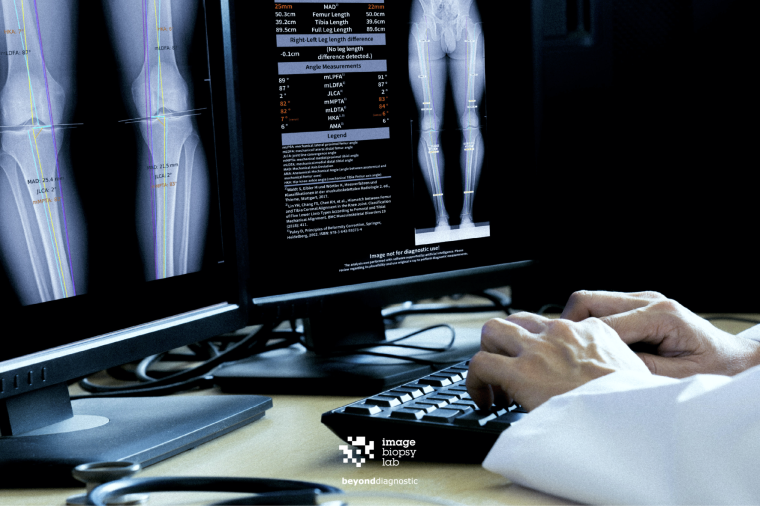 Foto: ImageBiopsy Lab