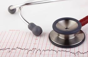 Foto: Getty Images 175447398