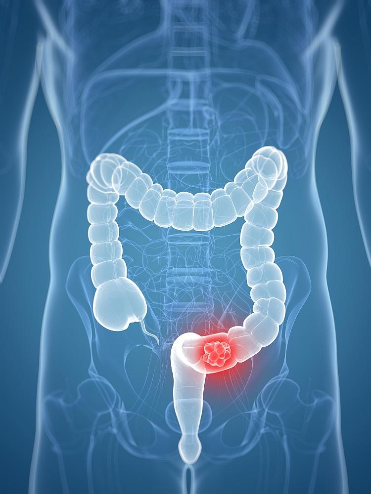 Foto: Getty Images 460713933