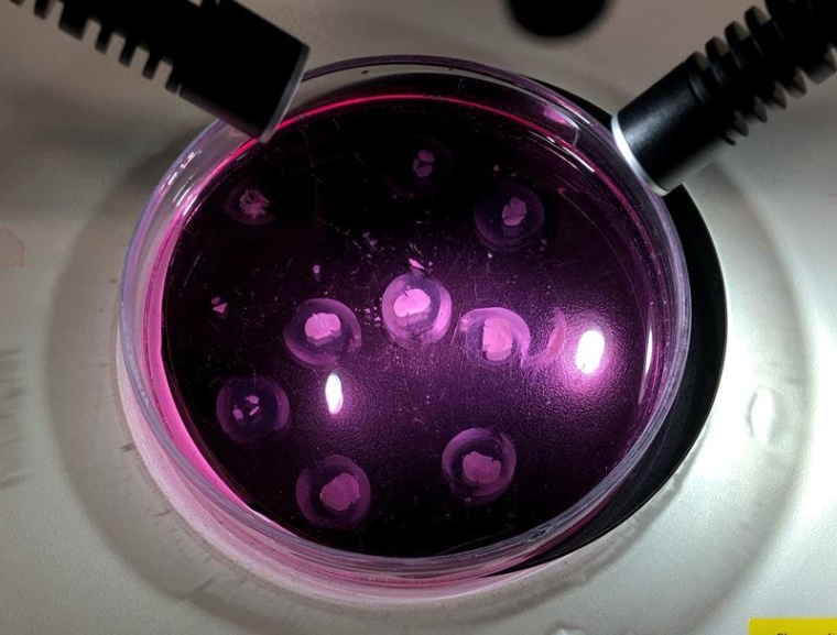 Das Team der Neurochirurgie am Uniklinikum Würzburg valididert das Drug...