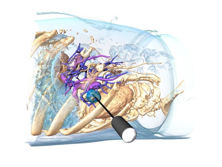 Mithilfe der entwickelten Softwarelösung „BioTrace IO 360“ wird anhand von...