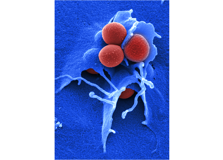 Invasion von Staphylococcus aureus in eine Wirtszelle Foto: HZI/Manfred Rohde