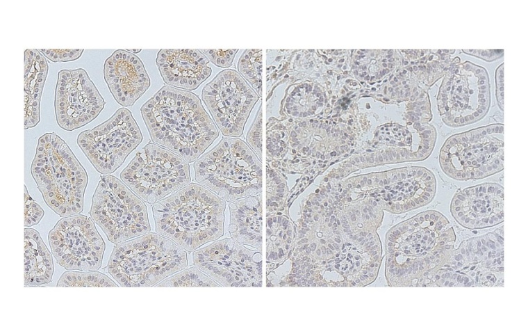 Dünnschnitte durch die Darmschleimhaut einer gesunden Maus (links) und einer...