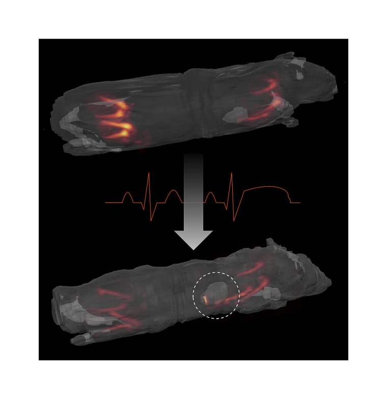 MRT-Aufnahme einer Maus vor und nach Myokardinfarkt. Oben sind die Neutrophilen...