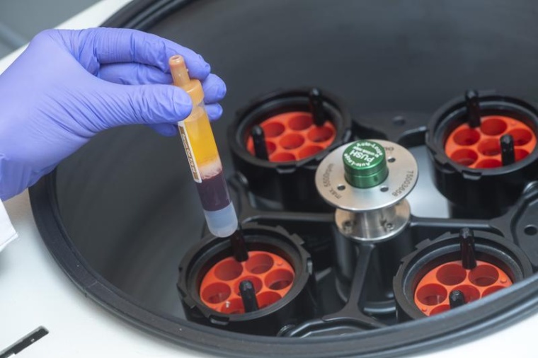 Die Blutproben der Studienteilnehmenden wurden zentrifugiert, um z. B. die...