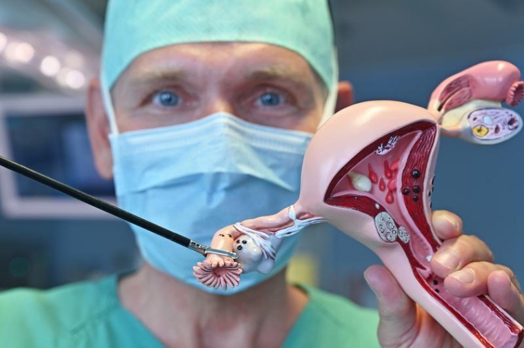 Prof. Ingo Runnebaum zeigt am Modell die Entfernung der Eileiter, eine bei...