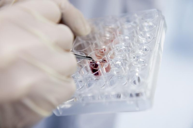 Damit Proben - hier z.B. aus Gewebe - und Daten von Studienteilnehmern in...