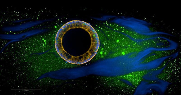 Zyste aus humanen induzierten pluripotenten Stammzellen, die in synthetischen...