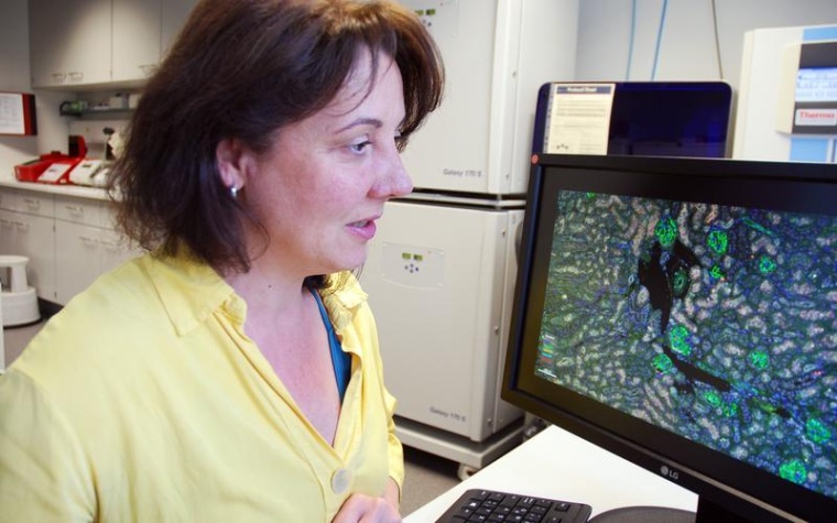 Eine Forschungsgruppe um PD. Dr. Ivonne Löffler vom Uniklinikum Jena...