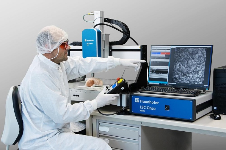 Laser-Scanning-Mikroskop zur Tumorabgrenzung, Foto: Fraunhofer IPMS