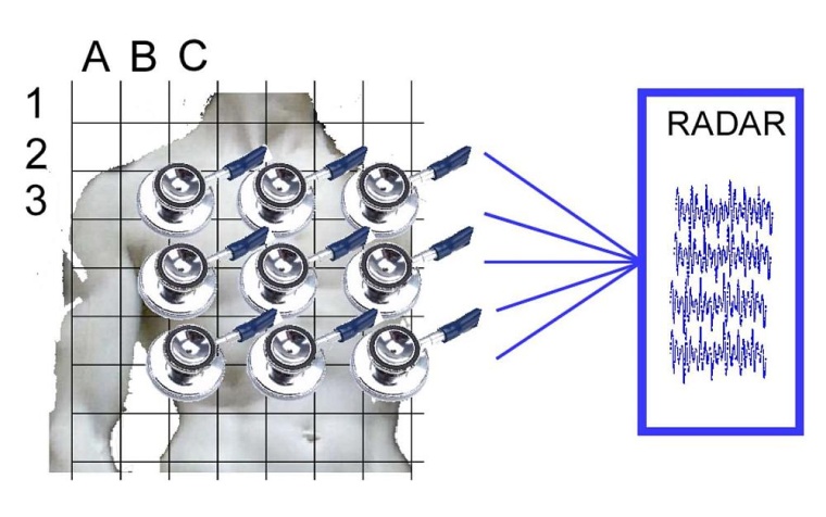 „Smart Analytics“: Im Projekt 3D Radar Scanner wird ein berührungsloser...