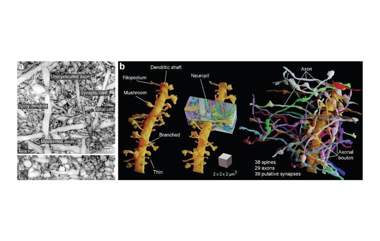 Lioness macht die Komplexität von dichtem Hirngewebe sichtbar. a: Komplexe...