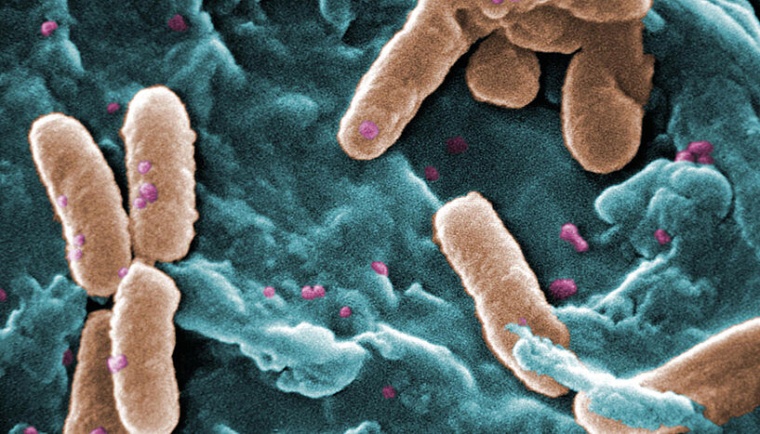 Pseudomonas aeruginosa ist ein gefürchteter Krankenhauskeim und kann besonders...