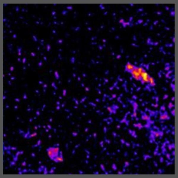 T-Zellen in der Lamina propria. Foto: N. Kawakami