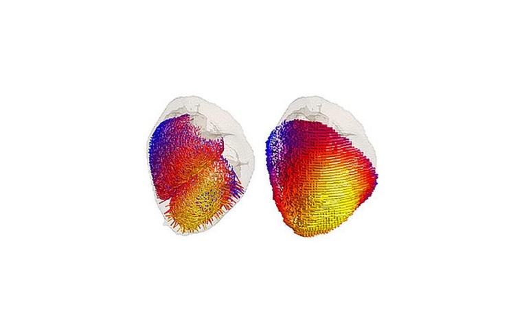 Das von Dr. Valerie Klein entwickelte Modell des Herzens mit den vorhergesagten...