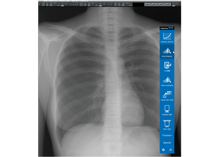 JVCKenwood erweitert seinen bewährten QA Medivisor Agent, die...