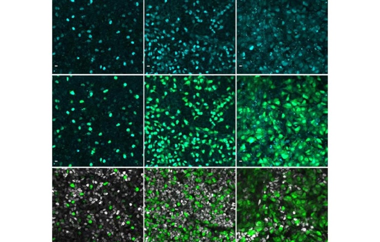 Immunofluoreszenzbilder zeigen das Gen NEUROG3 in Cyan in menschlichen Zellen...