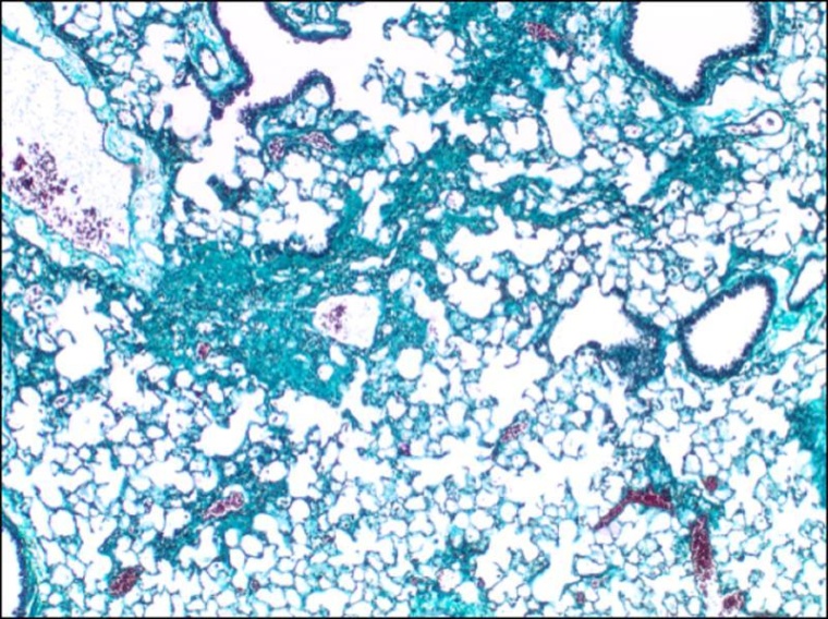 Forschende der Universitätsmedizin Mainz haben einen bisher unbekannten...
