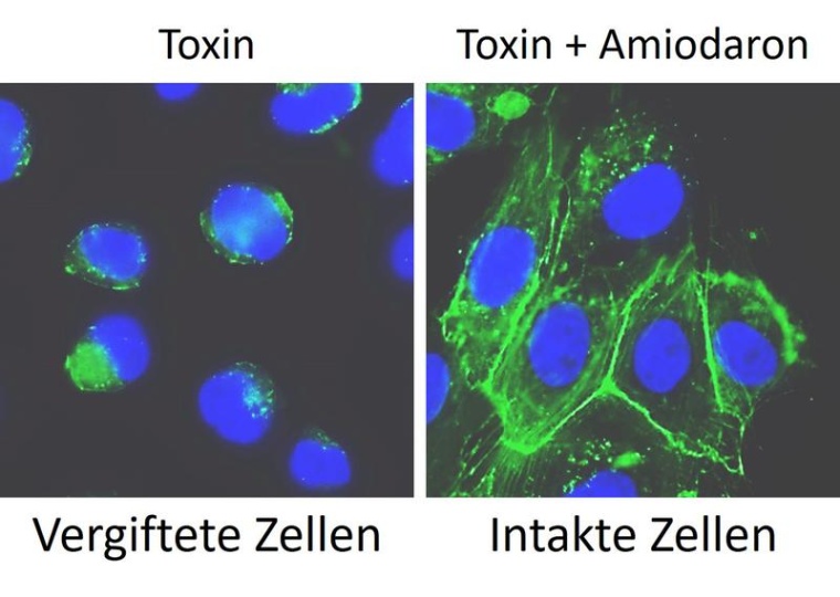 Links: In Zellen, die mit Clostridioides difficile-Toxin TcdB vergiftet wurden,...