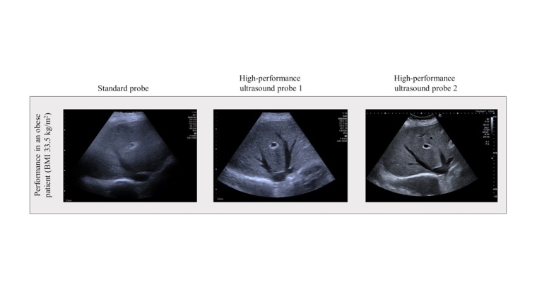 Bearbeitete Abbildung aus der Publikation: Untersuchung der Leber eines...