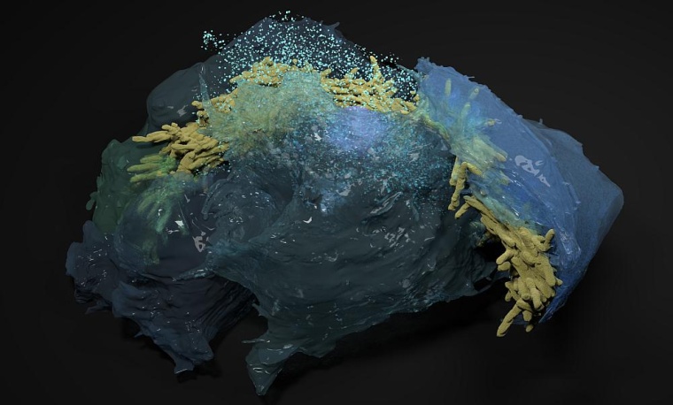 Unter dem Mikroskop sind Stränge aus Bakterien (gelb) erkennbar. Diese...