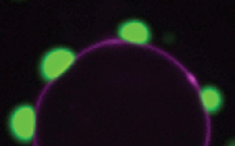 Diese mikroskopische Aufnahme zeigt Proteinkondensate (grün), die an einer...