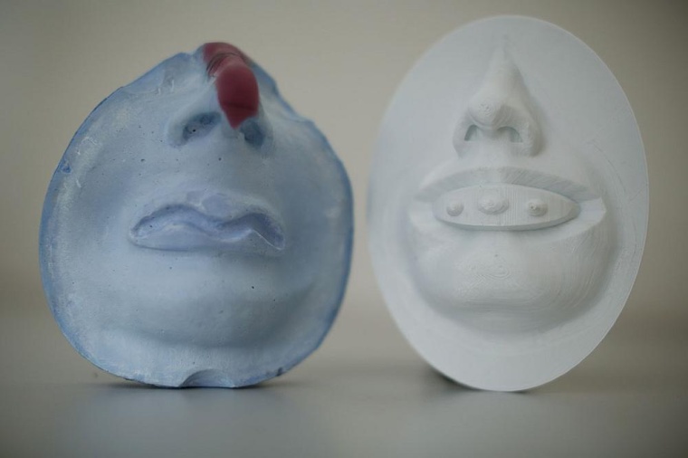 Links der modellierte Gipsabdruck des lange herkömmlichen...