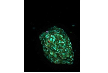 Organoidmodell eines Tumors. In solchen Modellen können das unkontrollierte...