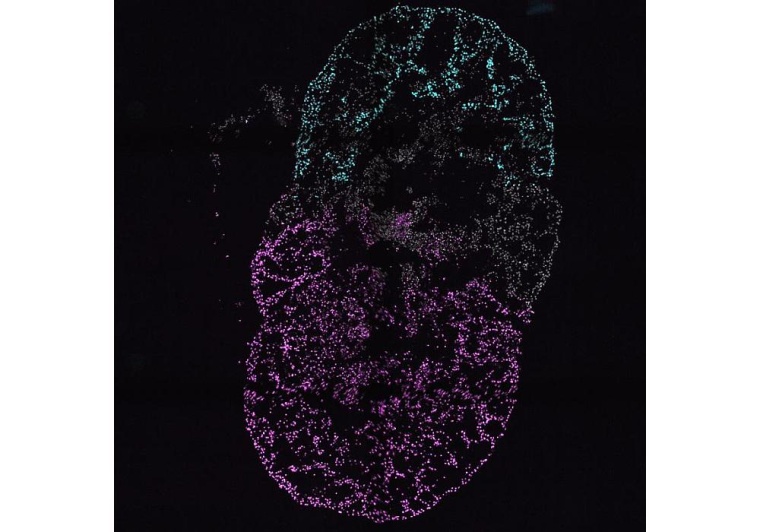 Querschnitt eines Mehrkammer-Kardioids, mit Vorhoforganoid (cyan), linkem...