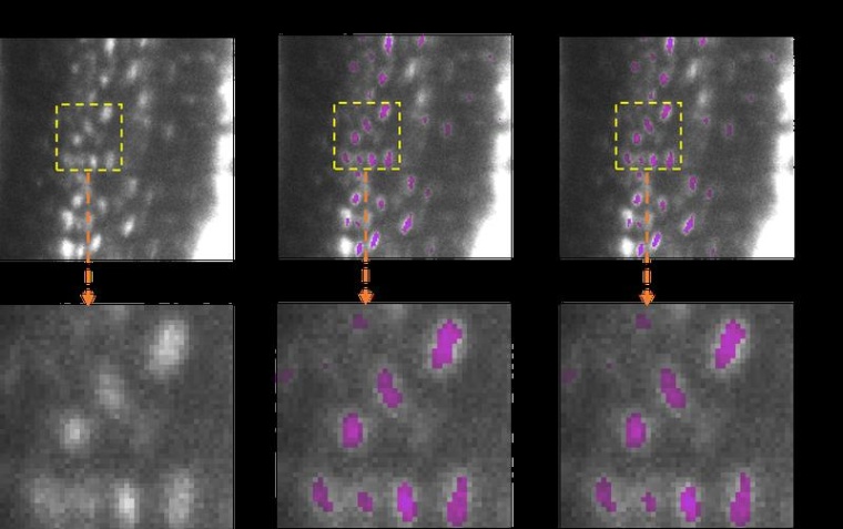 Semantische 3D-Segmentierung von Osteozyten in Mäuseknochen (Aufnahmen via...