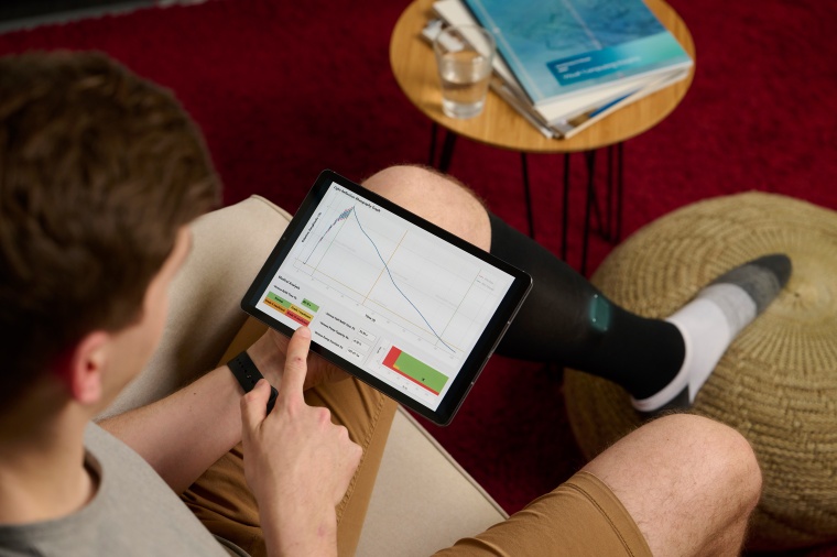 Ob ambulant oder stationär: veinXam kann dazu beitragen, Thrombosen früher zu...