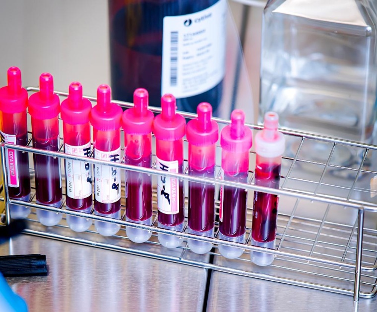 Bei 9 von 13 untersuchten chronischen Entzündungserkrankungen waren die...