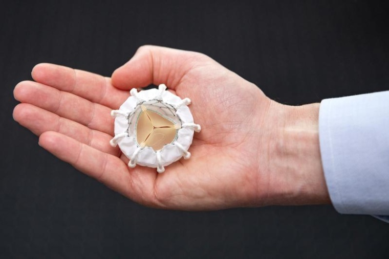 Die neuartige Prothese für die Trikuspidalklappe: Sie wird mithilfe eines...