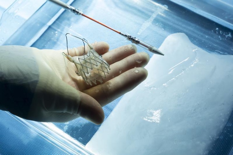 Herzersatzklappe (TAVI), Foto: Axel Kirchhof / UKE