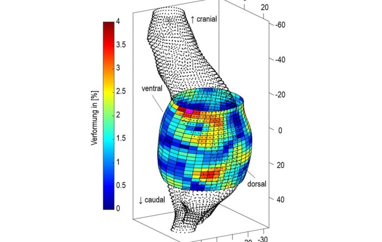 Rekonstruktion eines Bauchaortenaneurysmas mit Abmessungen in mm und...