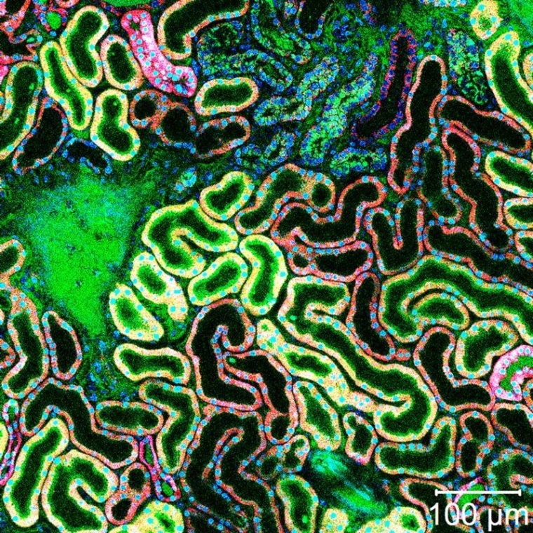 Gallensäure zerstört die Epithelzellen der Niere. Die Hemmung des dafür...