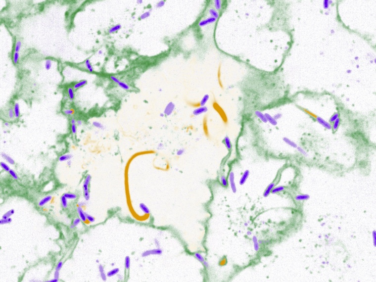 Der Erreger Burkholderia thailandensis (violett) verwendet Zellbestandteile...