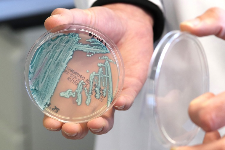 Auf Chromagarplatten wächst der Hefepilz Candida auris in blauen Kolonien....