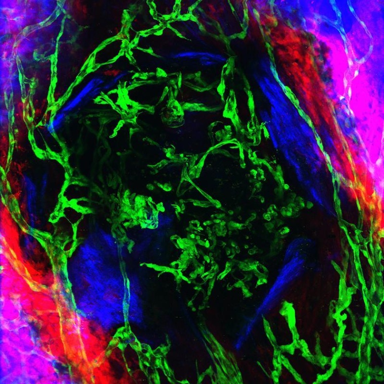 Blutgefäße (grün) durchziehen bereits die Knochenverletzung (blau), während...