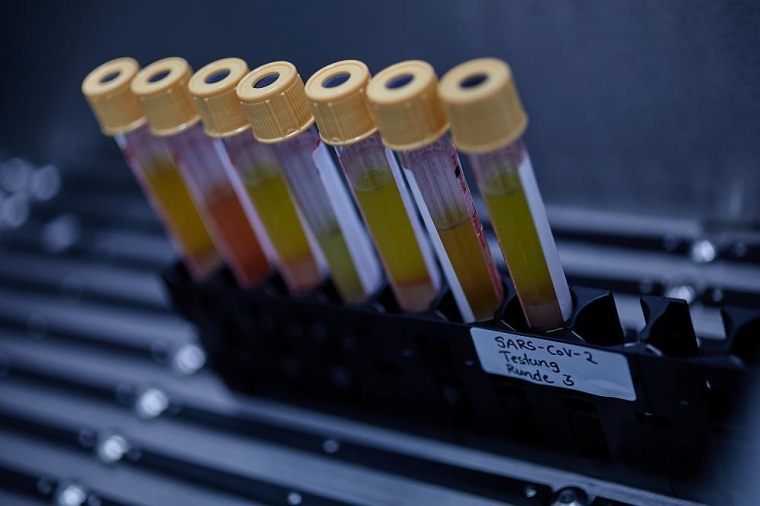 Dank der Einzelzell-Analyse von Blutproben ist klar: Dexamethason kann das...