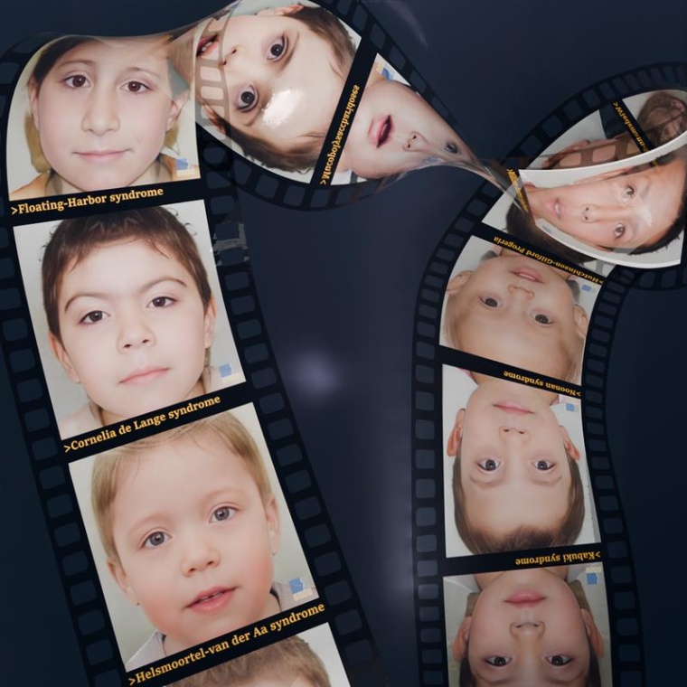 Photorealistische, synthetische Porträts unterschiedlicher Erkrankungen, die...