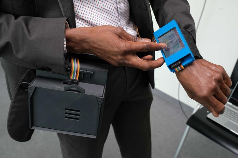 Klein und praktisch: Das Wearable wird am Handgelenk getragen und bündelt dort...